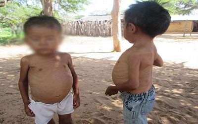 Desnutrición crónica infantil ronda el 30% en estados evaluados por Fundación Bengoa